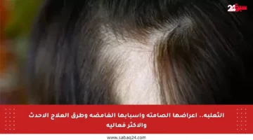 الثعلبة.. أعراضها الصامتة وأسبابها الغامضة وطرق العلاج الأحدث والأكثر فعالية